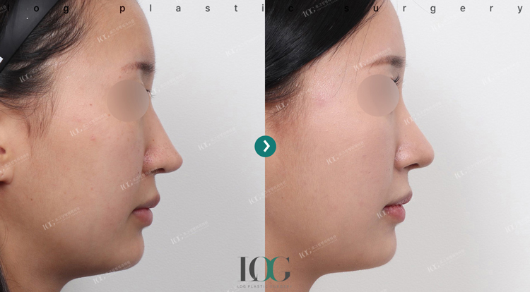 治療前・治療後